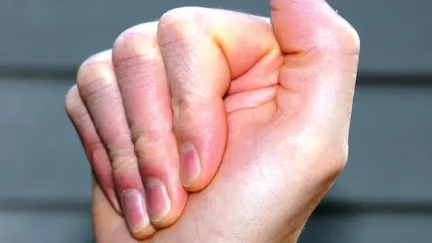 Hand Tendon Glide Exercise (Part 1) video thumbnail