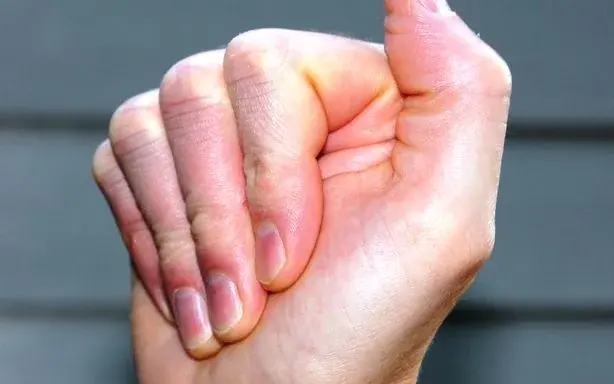 Hand Tendon Glide Exercise (Part 1) — exercise video thumbnail
