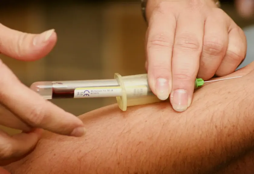 Blood sample being drawn into a syringe for platelet-rich plasma preparation